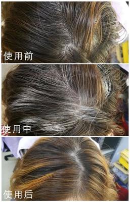 美國甜心傾心推薦，高科技頭發護理 告別煩惱，擁抱健康秀發